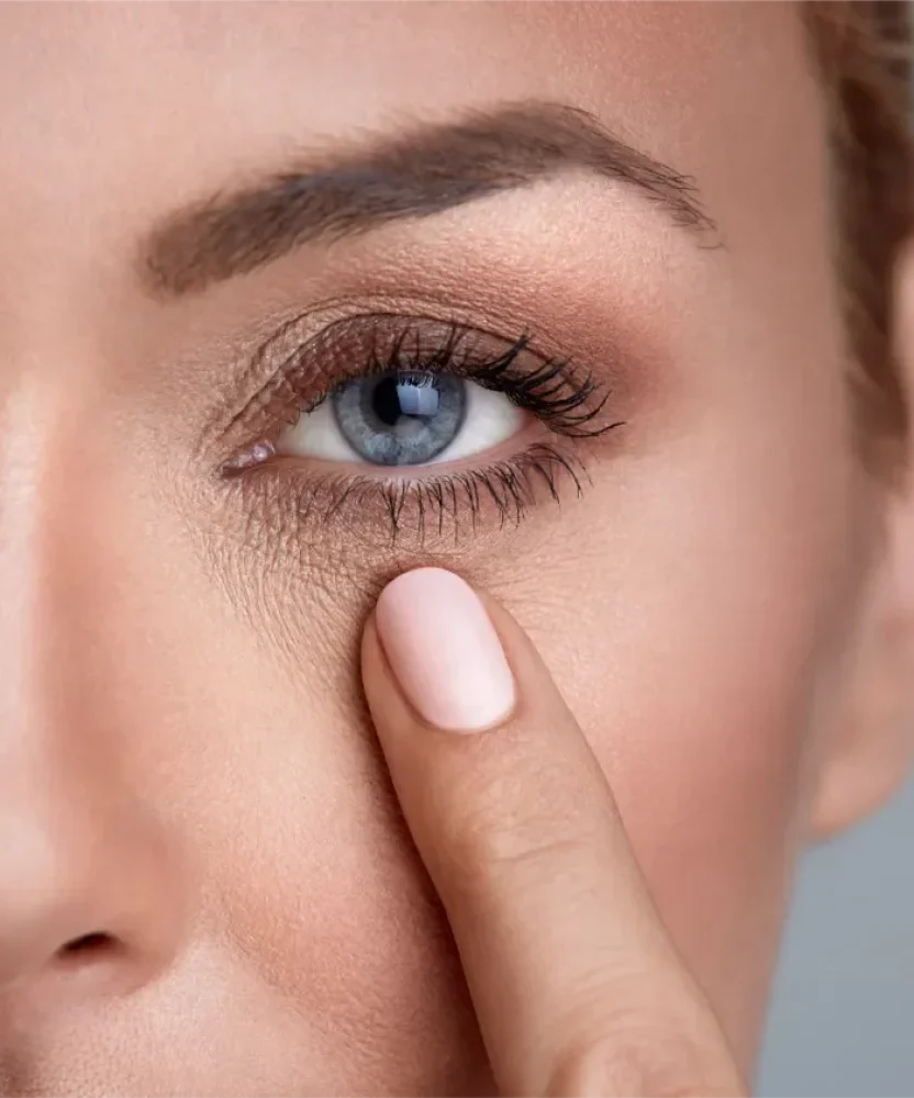 PRF-EZ Gel Under-Eye Rejuvenation in Houston TX