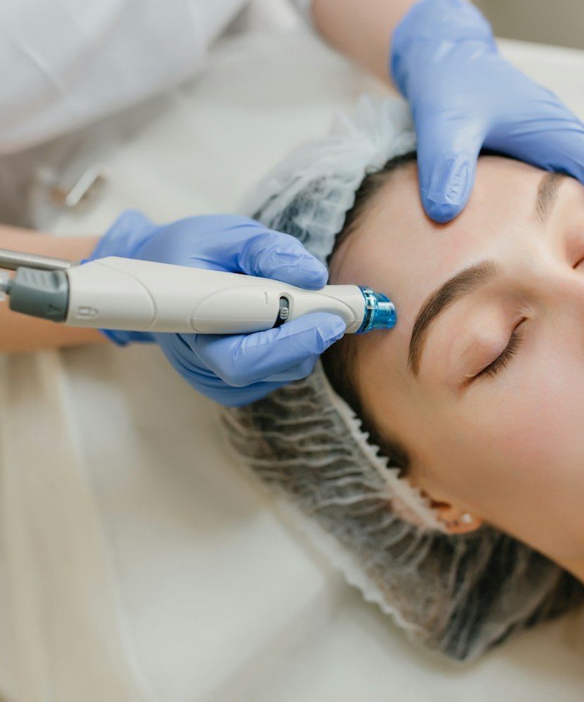 Microneedling with SkinPen in Houston TX